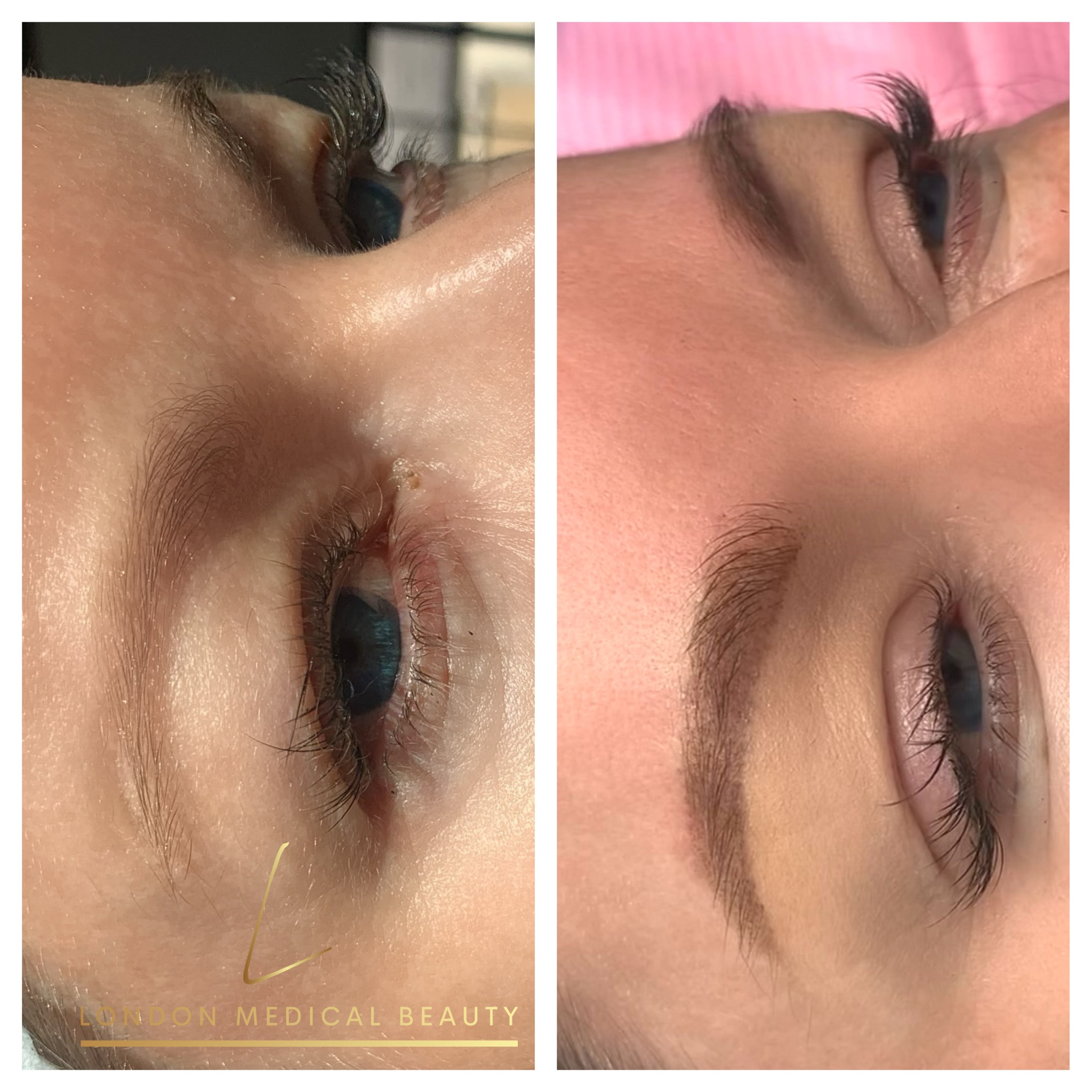Beauty treatment before and after