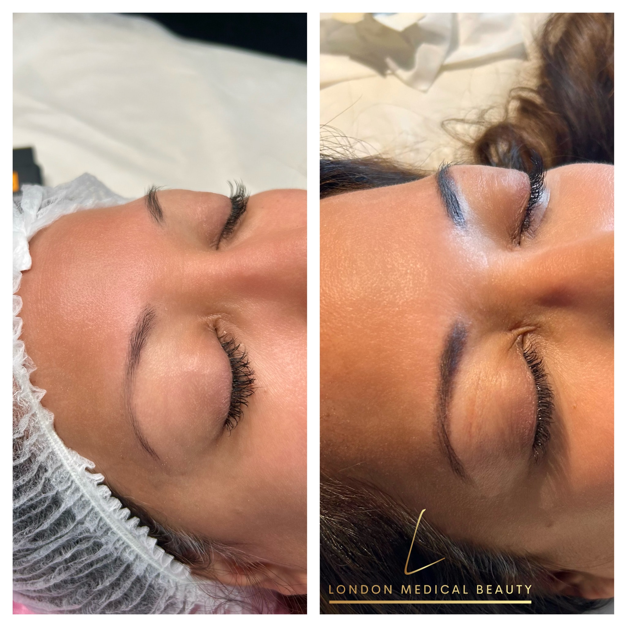Beauty treatment before and after