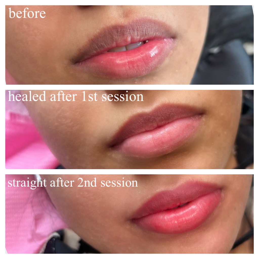 Beauty treatment before and after