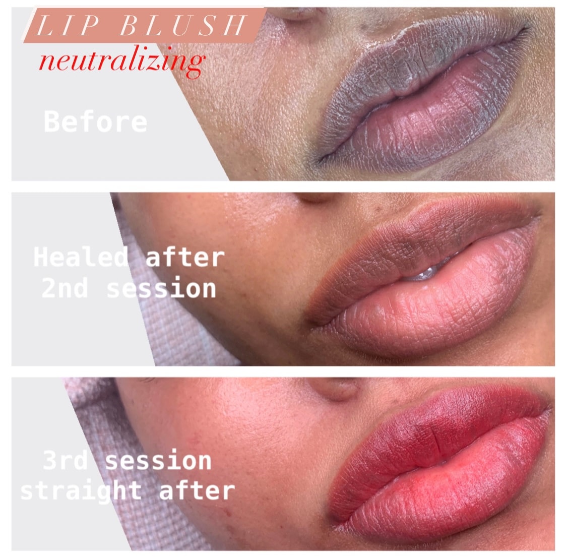 Lip blush neutralizing treatment