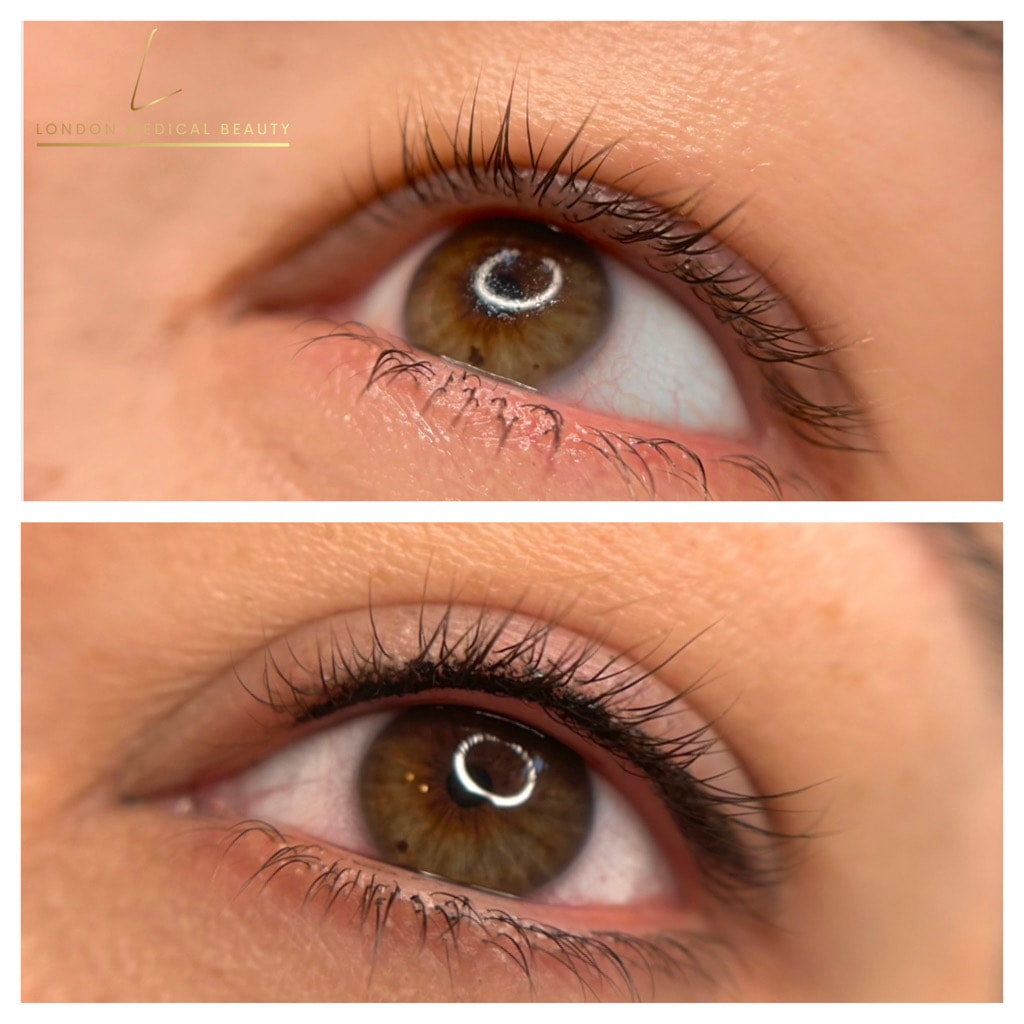 Eye lash lift before and after